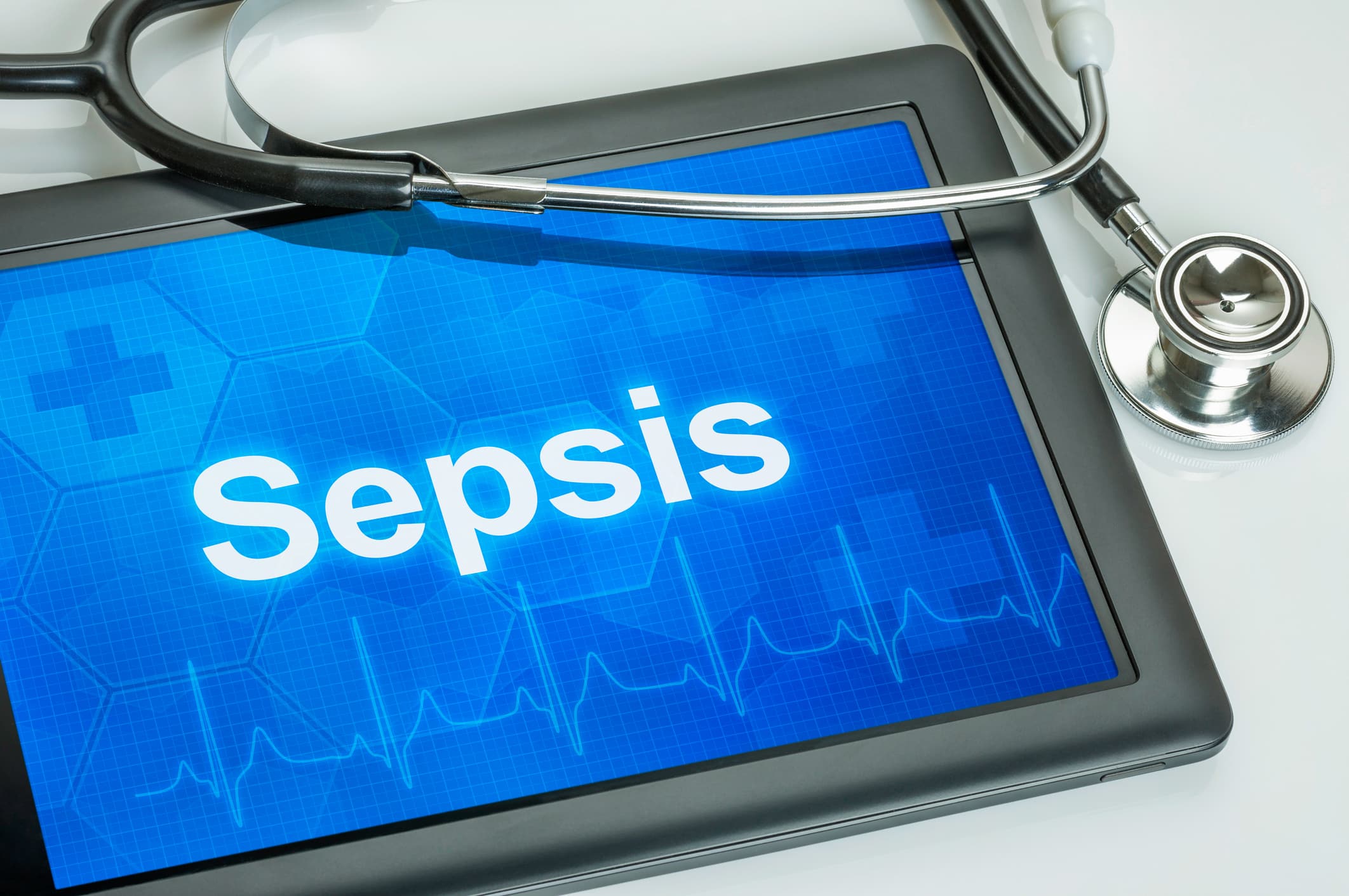 What is Sepsis?