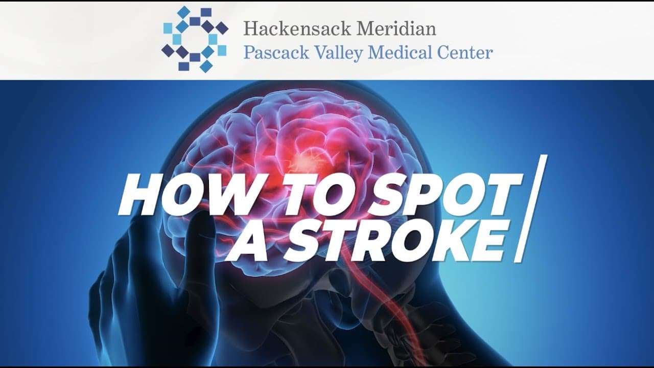 How to Spot a Stroke